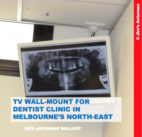 TV WALL-MOUNT FOR  DENTIST CLINIC IN MELBOURNE’S NORTH-EAST